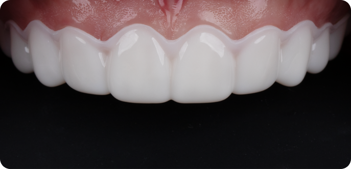TrialSmile™